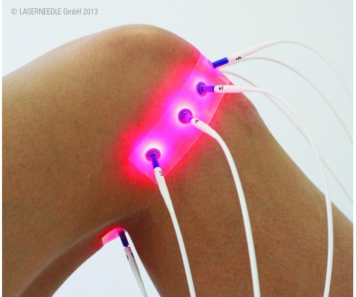 LaserNeedle - światłowodowy laser dla Ortopedii i Sportu - wersja na stoliku - 5 kanałów R + 5 kanałów IR