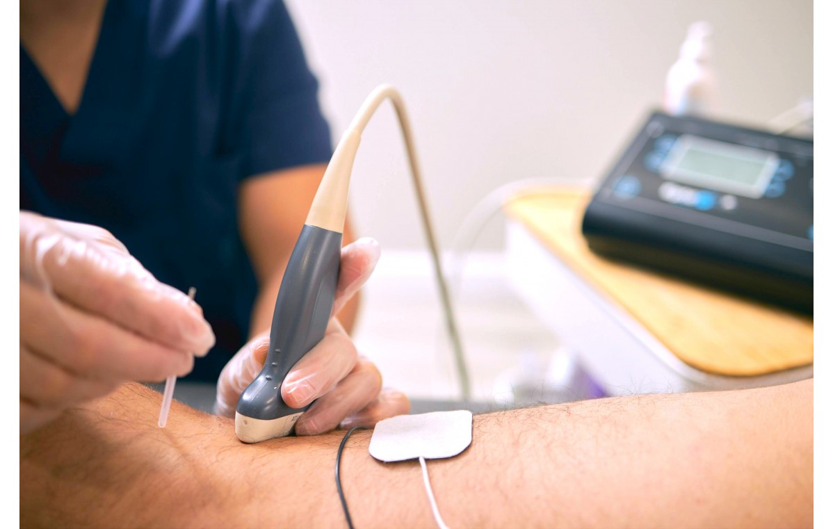 Warszawa - Przezskórna Neuromodulacja NMP, kurs intensywny - 6-8 marca 2025