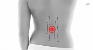 Leczenie falą uderzeniową dolnego odcinka kręgosłupa