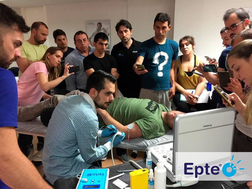 epte igły igłowanie