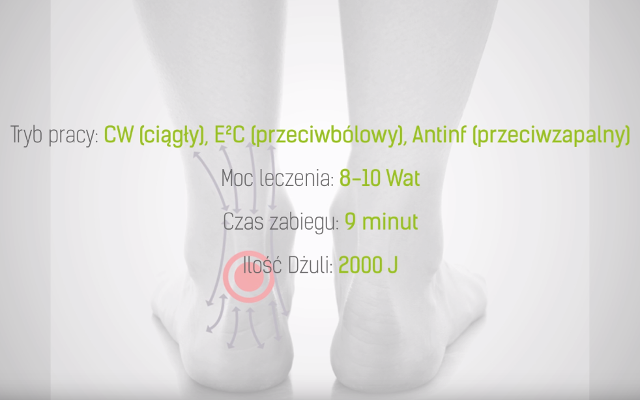 Leczenie ścięgna Achillesa laserem wysokoenergetycznym - parametry zabiebu