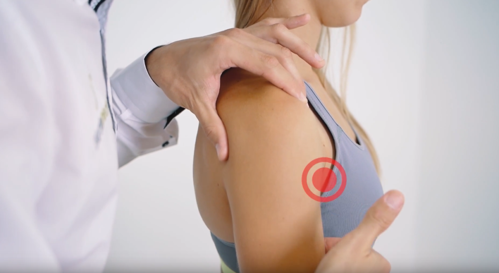 Leczenie naderwania mięśnia - laser wysokoenergetyczny