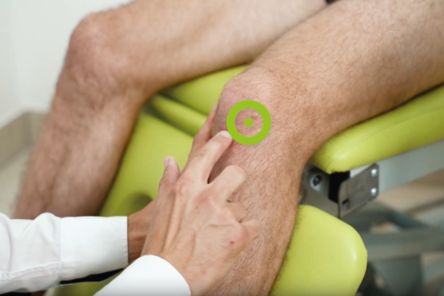 Terapia TECAR w leczeniu zwyrodnienia stawu kolanowego