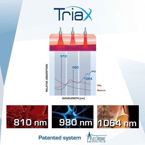 System TRIAX - 3 długości fal w laserze wysokoenergetycznym