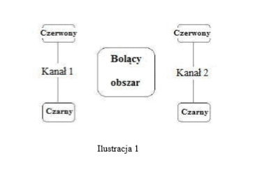 Ułożenie elektrod podczas elektrostymulacji TENS