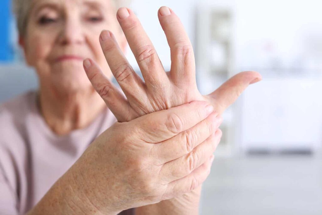 Ból i obrzęk dłoni - objawy reumatoidalnego zapalenia stawów