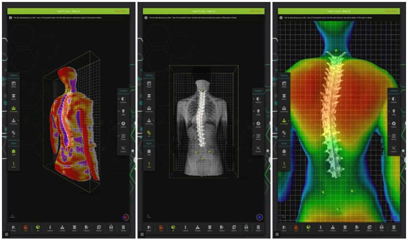 Badanie wad postawy urządzeniem Spine 3D