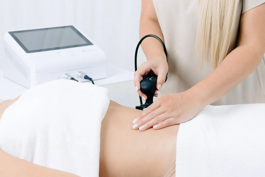 Terapia TECAR jako zabieg wyszczuplający na brzuch, biodra, uda i redukujący cellulit