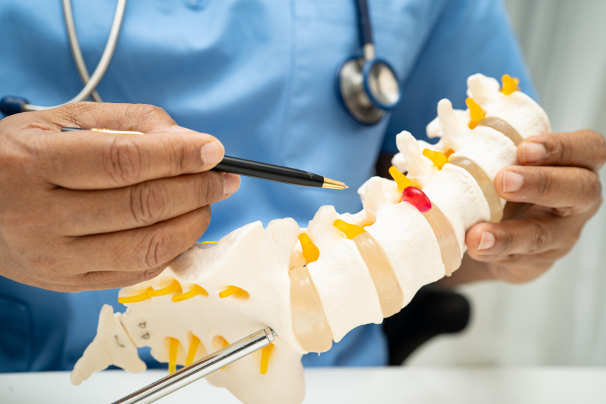 Urazy krążków międzykręgowych