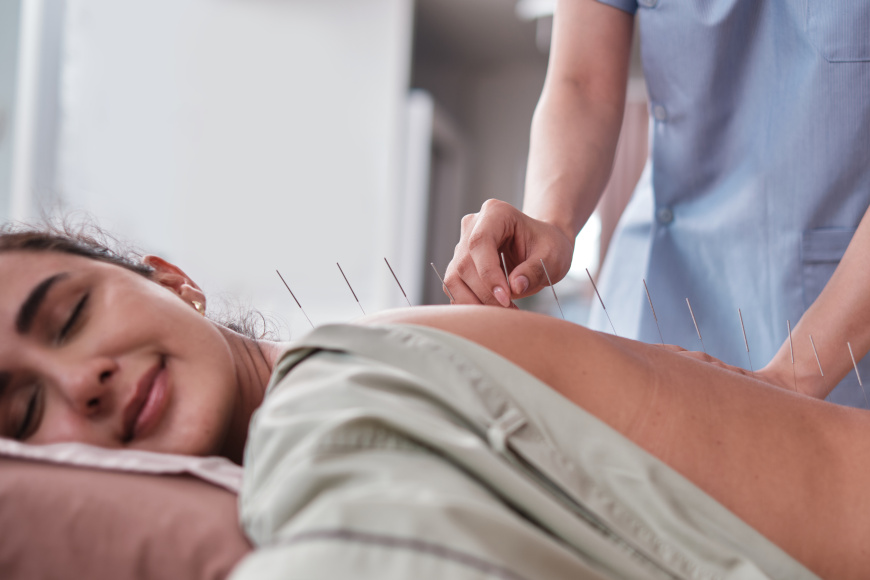 Pinoterapia (pinopresura) a terapie z użyciem igieł – podobieństwa i różnice