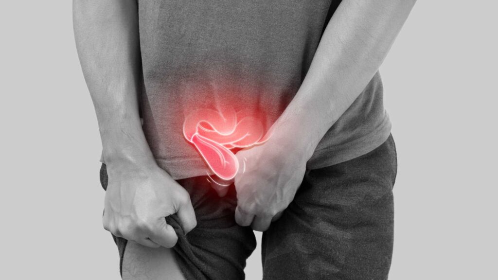 Przepuklina pachwinowa – leczenie i rehabilitacja